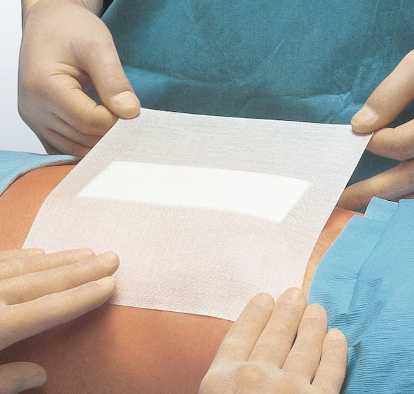 Bild eines Fixierverbands von BSN Medical. Der Verband hat eine Breite von 20 cm und ist in einer transparenten Verpackung zu sehen. Die Verpackung zeigt die Produktbezeichnung, die spezifischen Merkmale sowie Anwendungshinweise. Der Verband selbst ist aus einem flexiblen, atmungsaktiven Material gefertigt, das eine zuverlässige Fixierung von Wunden und Verbänden ermöglicht. Die Oberfläche des Verbands ist leicht strukturiert, um eine bessere Haftung zu gewährleisten.